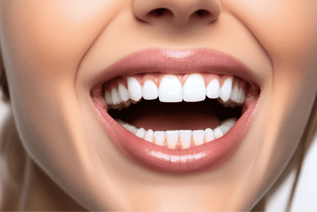 Smile Designing