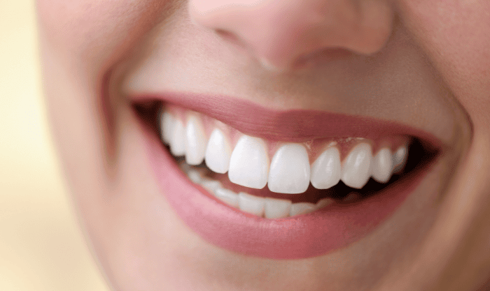 Smile Designing