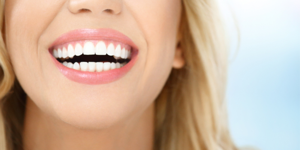 Smile Designing