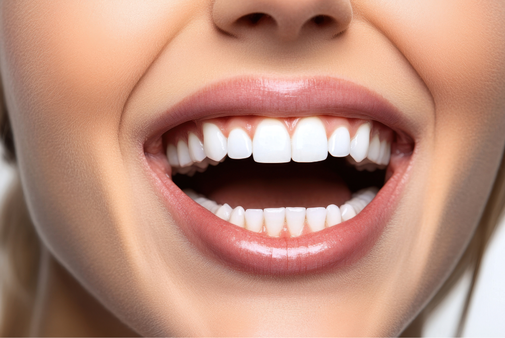 Smile Designing